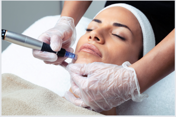 อะไรคือความแตกต่างระหว่าง microneedling และ Mesotherapy?